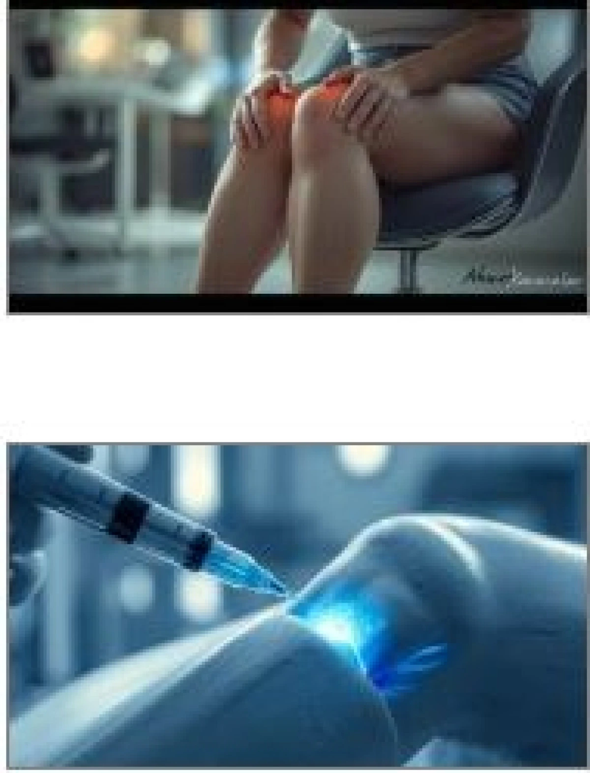 Diz Ağrıları ve Diz &Ccedil;evresi Yağlanmanın Arkasında Lip&ouml;dem Olabilir