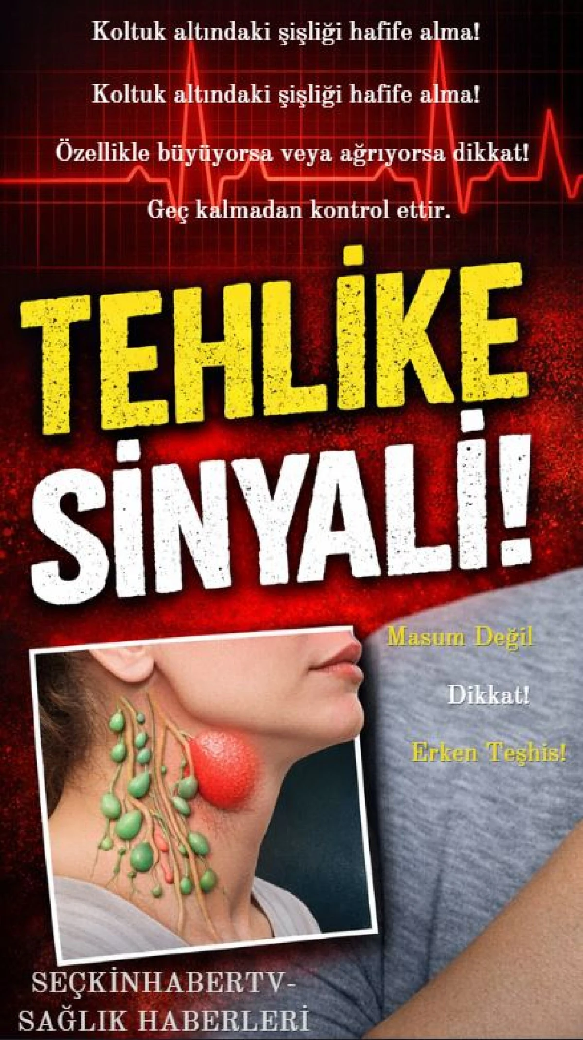 Koltuk Altındaki Şişliği Hafife Almayın: Uzmanlardan &ldquo;Ektopik Meme Dokusu&rdquo; Uyarısı